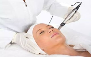 traitement microneedling visage